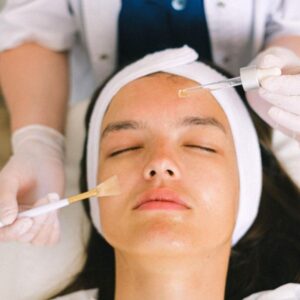 peeling facial clinica medico estetica madrid